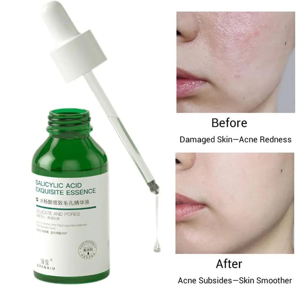 Salicylic Acid Pore Shrinking Essence