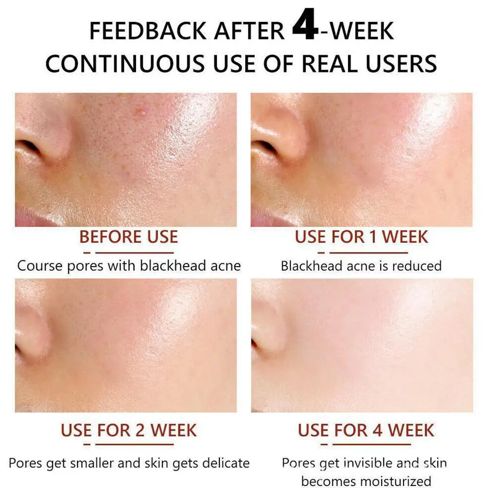 Salicylic Acid Pore Shrinking Essence