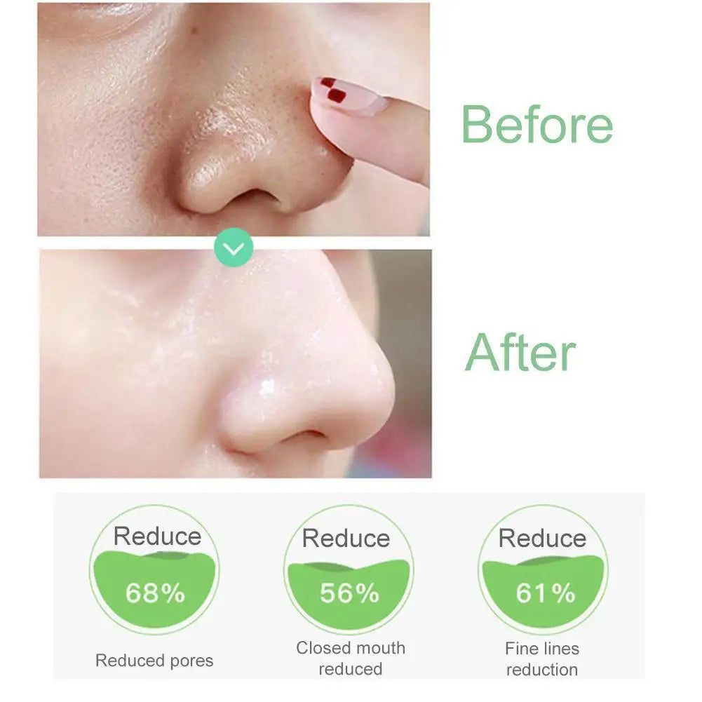 Salicylic Acid Pore Shrinking Essence
