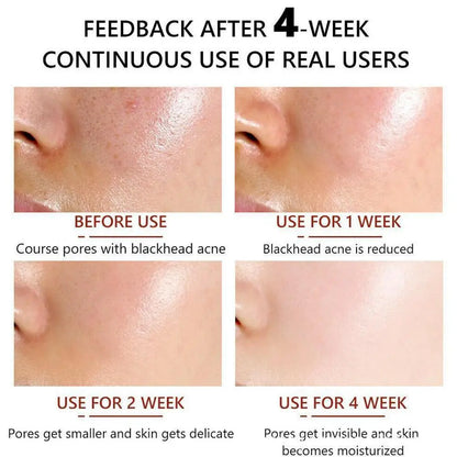 Salicylic Acid Pore Shrinking Essence